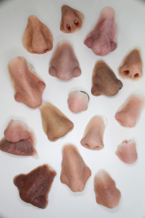 Anapedia Anaplastology Care