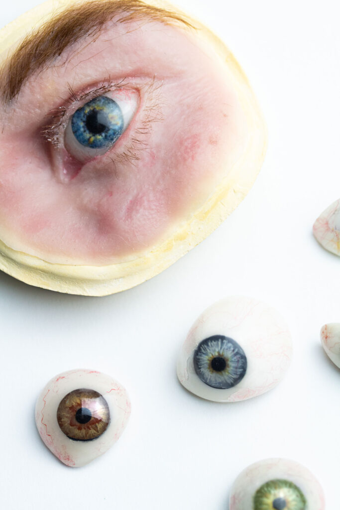 Anaplastology Care